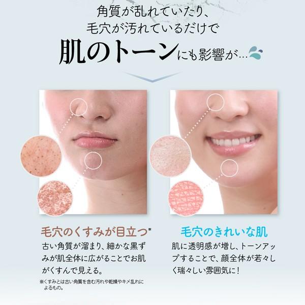 初雪の雫 洗顔 泡 毛穴 練り せっけん 石鹸 ジャータイプ 泡 105g 約1
