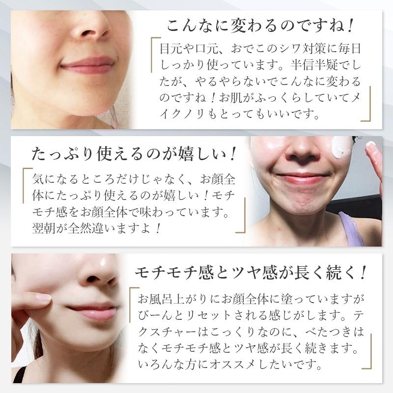 初雪の雫 薬用 シワ改善 しわ予防 美白リンクルクリーム 15g : ジェイ