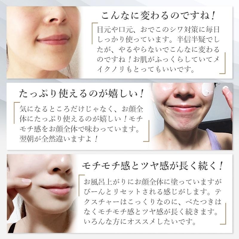 初雪の雫 薬用 シワ改善 しわ予防 美白リンクルクリーム 30g : ジェイ