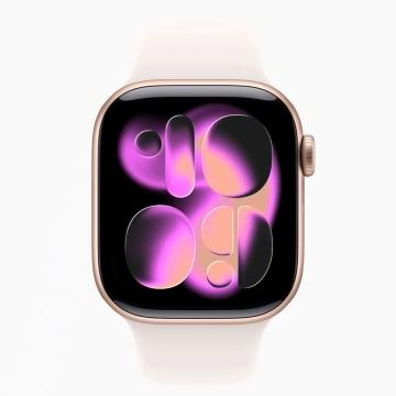 未使用】Apple Apple Watch Series11 42mm GPS ローズゴールド 