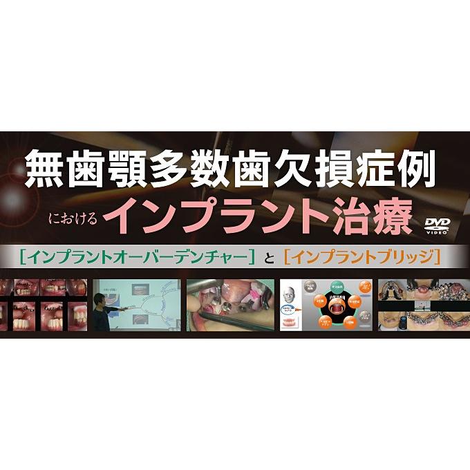 無歯顎多数歯欠損症例におけるインプラント治療 皆川仁 歯科 DE175-S 全3巻 | ジャパンライム