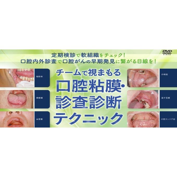 チームで視まもる口腔粘膜・診査診断テクニック 歯科 DE177-S 全1巻 | ジャパンライム