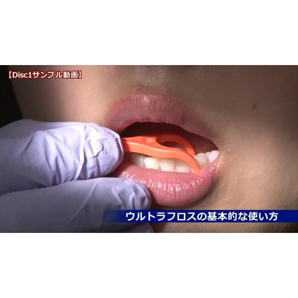 すぐに役立つ 歯科医院で行う口腔清掃指導と禁煙支援のポイント 歯科 たばこ 煙草 DE181-S 全2巻 | ジャパンライム | 02