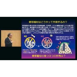 インプラント治療のリッジマネジメントを究める 歯科 DE182-S 児玉利朗 全2巻 | ジャパンライム | 02