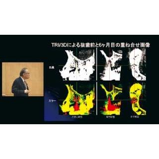 インプラント治療のリッジマネジメントを究める 歯科 DE182-S 児玉利朗 全2巻 | ジャパンライム | 04