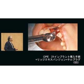 インプラント治療のリッジマネジメントを究める 歯科 DE182-S 児玉利朗 全2巻 | ジャパンライム | 05