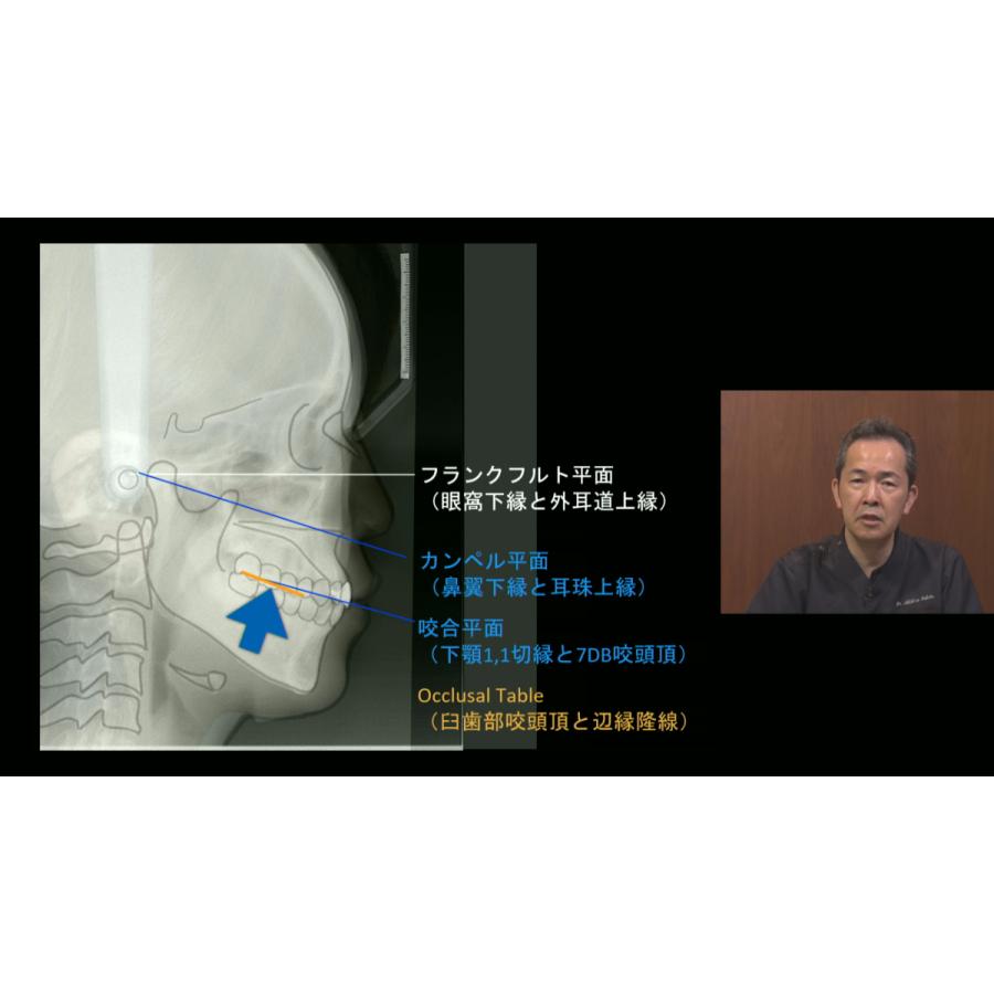 Dr.懸田の『誰にでもわかる咬合学シリーズ』咬合の計画から治療まで 歯科 DE184-S 全1巻 | ジャパンライム | 02