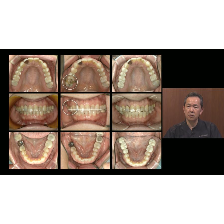 Dr.懸田の『誰にでもわかる咬合学シリーズ』咬合の計画から治療まで 歯科 DE184-S 全1巻 | ジャパンライム | 07