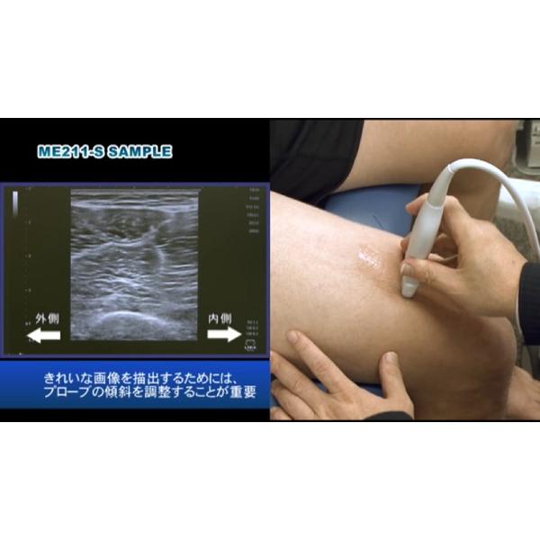 運動器リハビリテーションのための超音波画像描出テクニック【全２巻】ME211 ジャパンライム 運動器リハビリテーションのための超音波画像描出