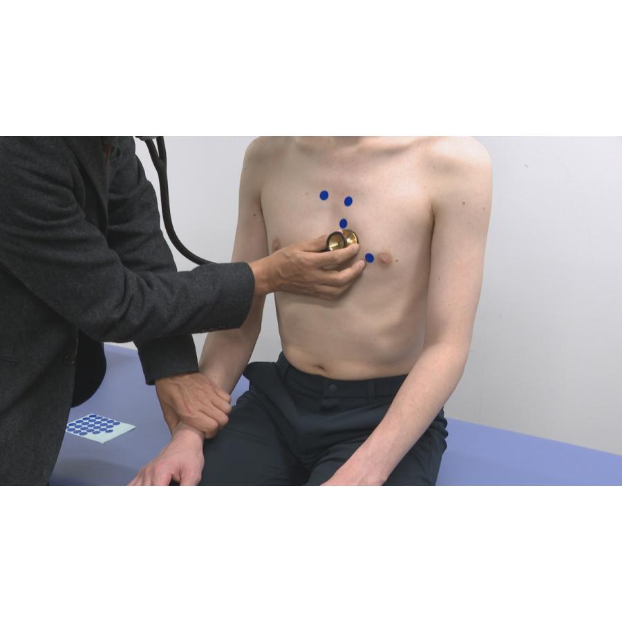 高齢心不全患者に対する理学療法 ME281-S 理学療法 全2巻 | ジャパンライム | 02