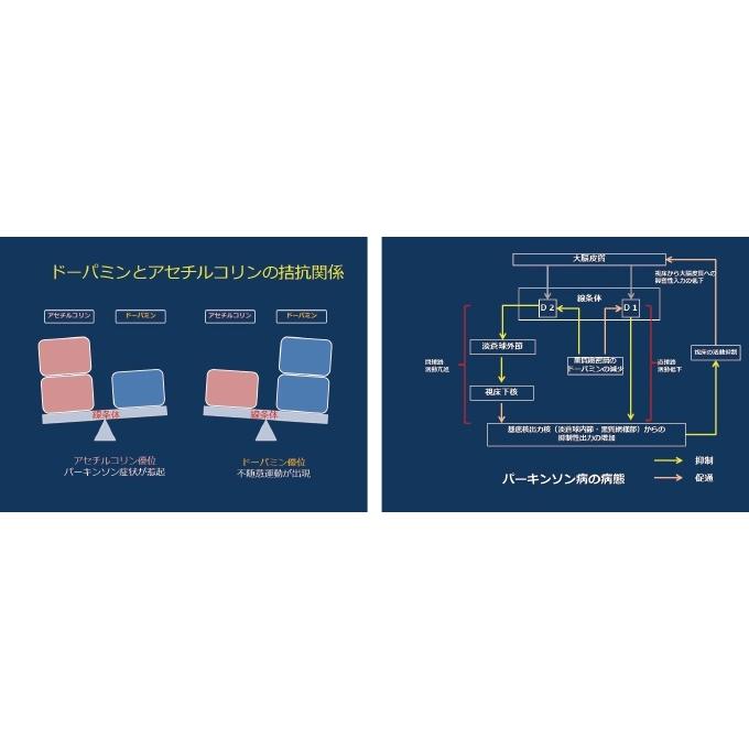 パーキンソン病の理学療法 〜パーキンソン病の基本と歩行障害への対応〜[理学療法 ME294-S 全2巻・分売不可] | ジャパンライム | 03