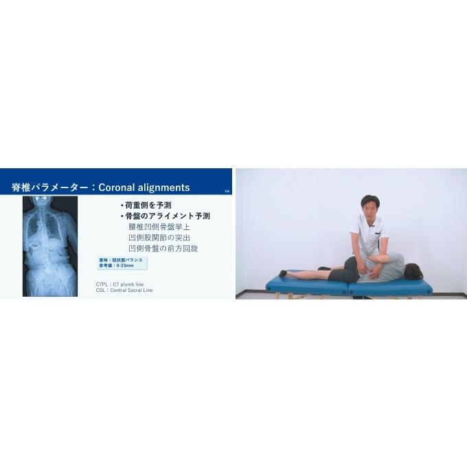 腰椎変性疾患術後の理学療法ガイド[理学療法 ME296-S 全4巻・分売不可] | ジャパンライム | 04