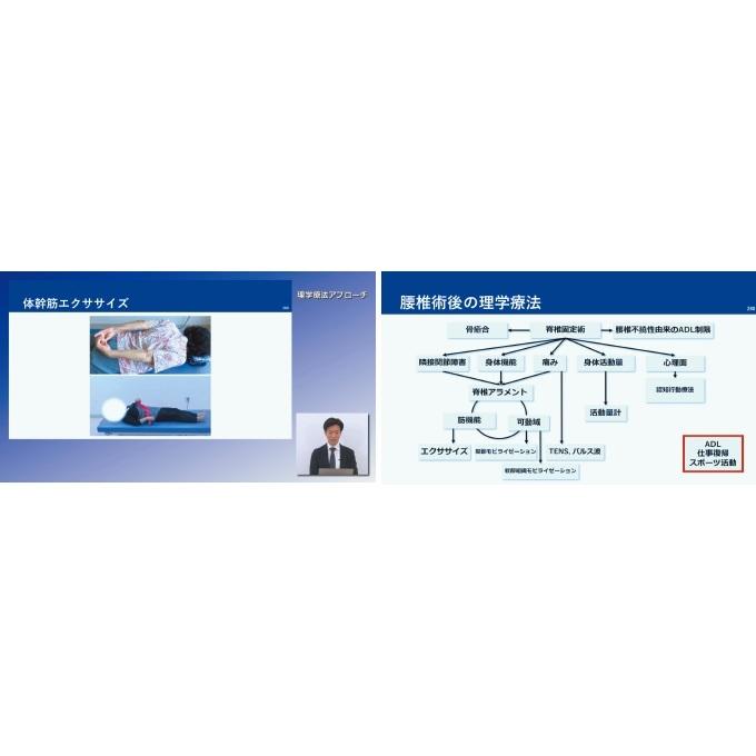 腰椎変性疾患術後の理学療法ガイド[理学療法 ME296-S 全4巻・分売不可] | ジャパンライム | 05
