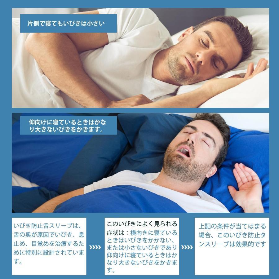 いびき 防止 改善 グッズ 舌ピタ 安眠 無呼吸 水洗い可能 ホワイト Amazon.co.jp: いびき防止グッズ 舌用マウスピース 舌ピタ