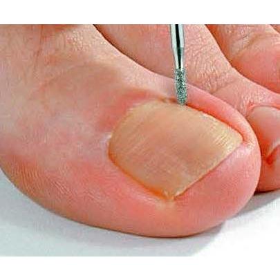 ネイルグラインダー Promed feeling アタッチメントバー5本セット