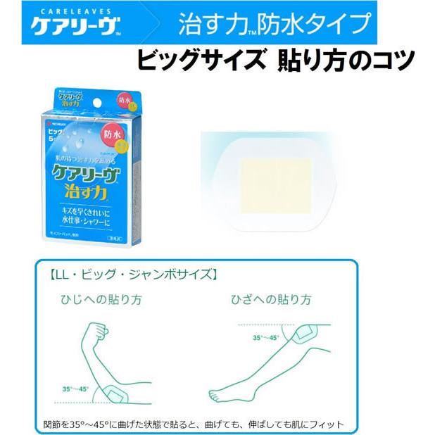 【管理医療機器】ニチバン 【医療機器】ケアリーヴ治す力 防水 ビッグサイズ 5枚  キズバンド ケガ キズ メディカル｜jetprice｜06