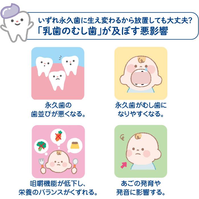ポイント15倍 L8020乳酸菌使用 薬用ハミガキジェル 50g×4本 いちご風味 子供用 フッ素 キシリトール  爆買 | チュチュベビー | 09