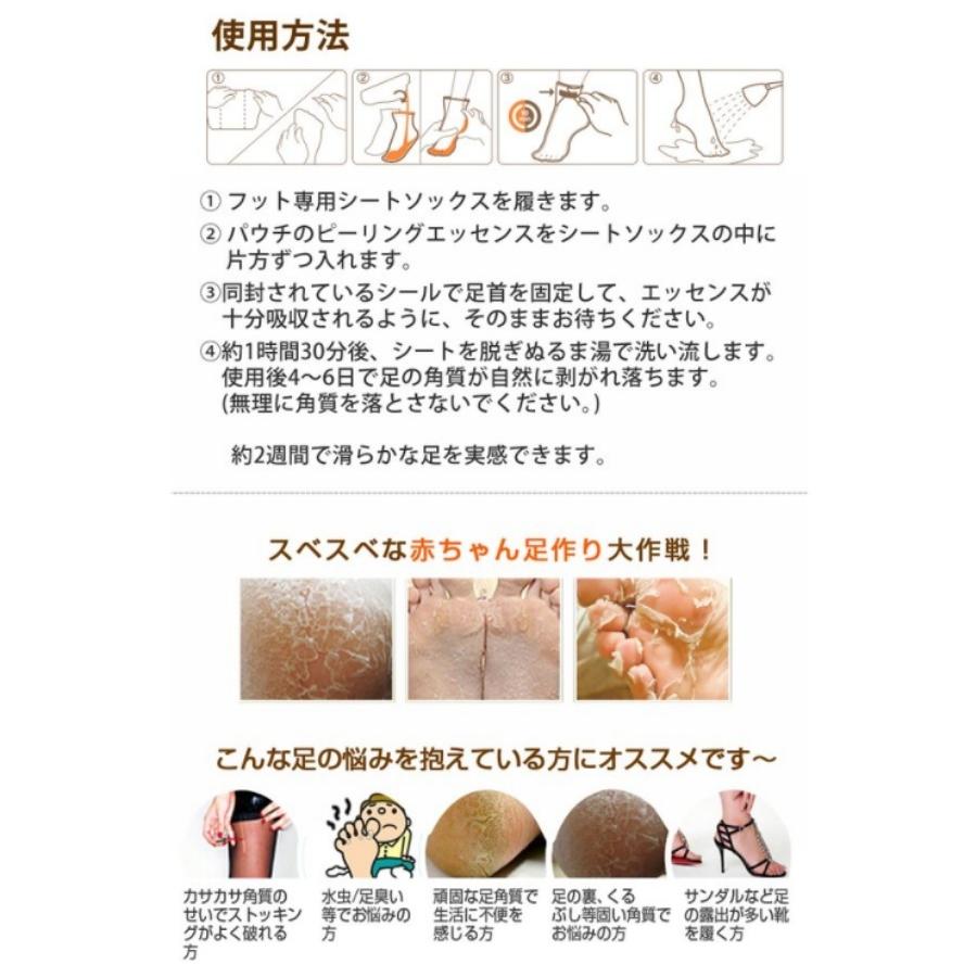 驚きの値段で メール便 送料無料 ミジンケア 足角質ケア Mjcare 韓国コスメ ソフト ミラクル フットケア 角質除去 足ピーリングパック フット 5枚 Mijin 韓国 Mainweltmusikfestival De