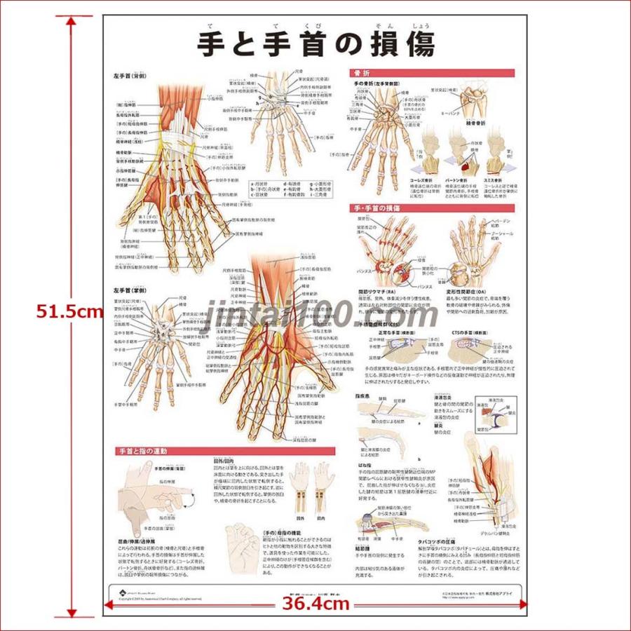 手と手首の損傷 J44p 人体図 医学ポスター 世界一流のメディカルイラスト J44r 人体百科 通販 Yahoo ショッピング