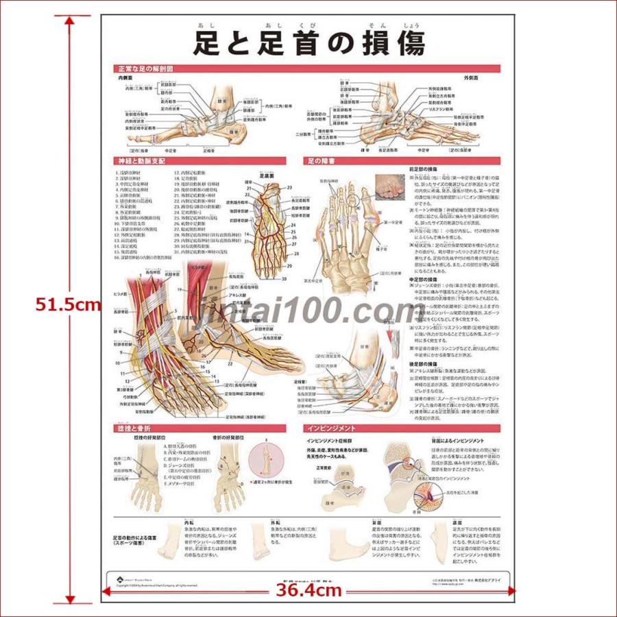 足と足首の損傷 J79p 人体図 医学ポスター 世界一流のメディカルイラスト J79p 人体百科 通販 Yahoo ショッピング
