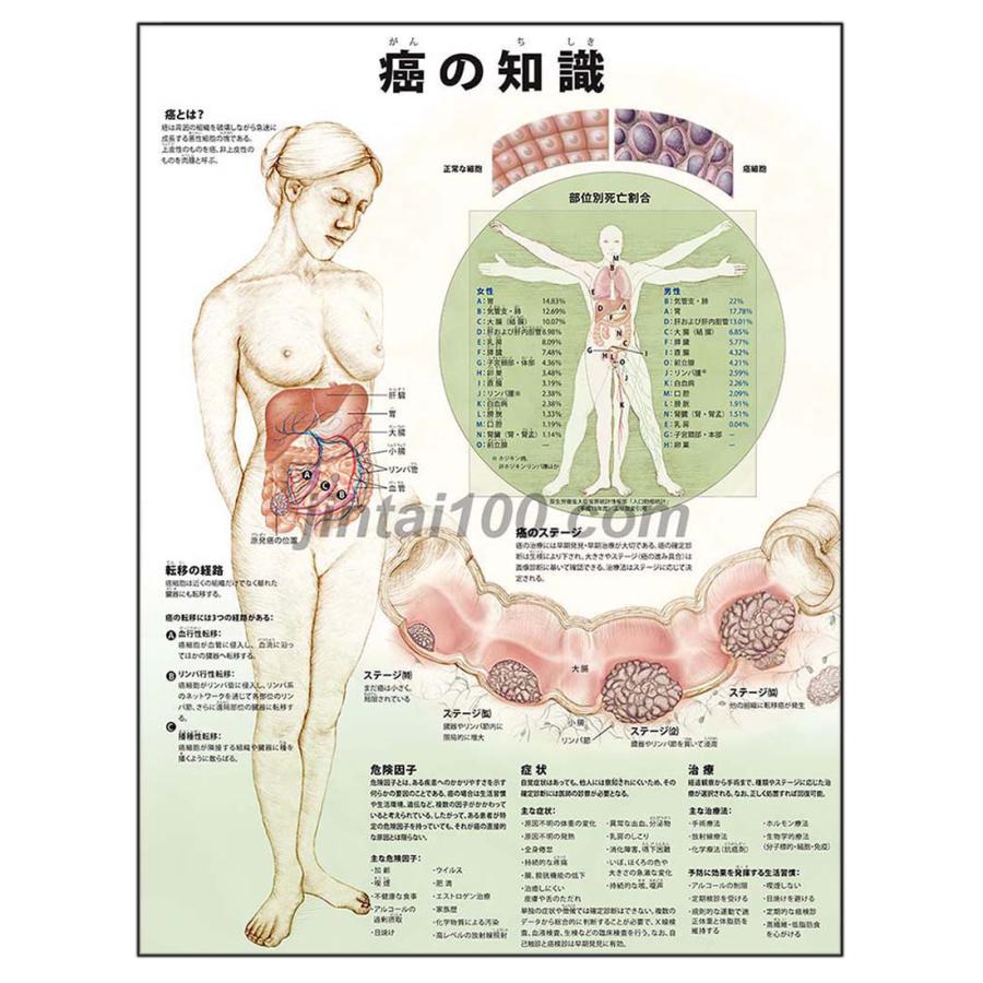 癌の知識 J9756p 人体図 医学ポスター 世界一流のメディカルイラスト J9756p 人体百科 通販 Yahoo ショッピング