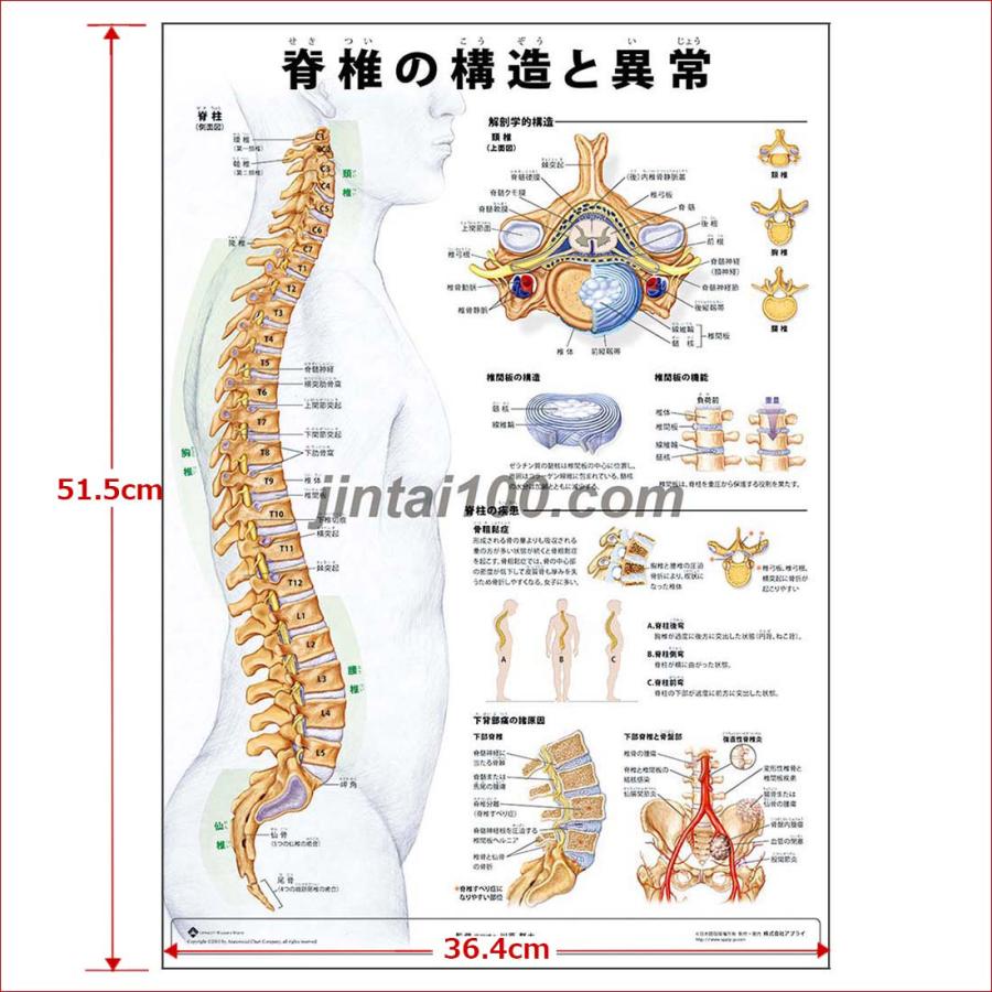 脊椎の構造と異常」医学ポスター ポスターB3サイズ 人体解剖学図