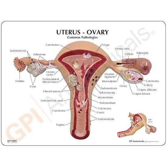 医療用、模型。子宮 子宮の解剖模型 - 3480 - GPI Anatomicals - 卵巣の / 実習用