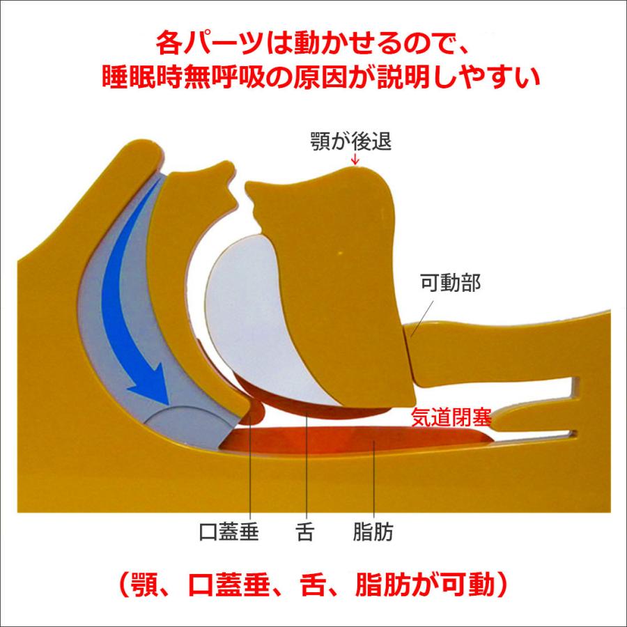 「睡眠時無呼吸症候群（OSAS）」医学模型 解剖学模型 疾患説明用模型｜jintan-100｜02