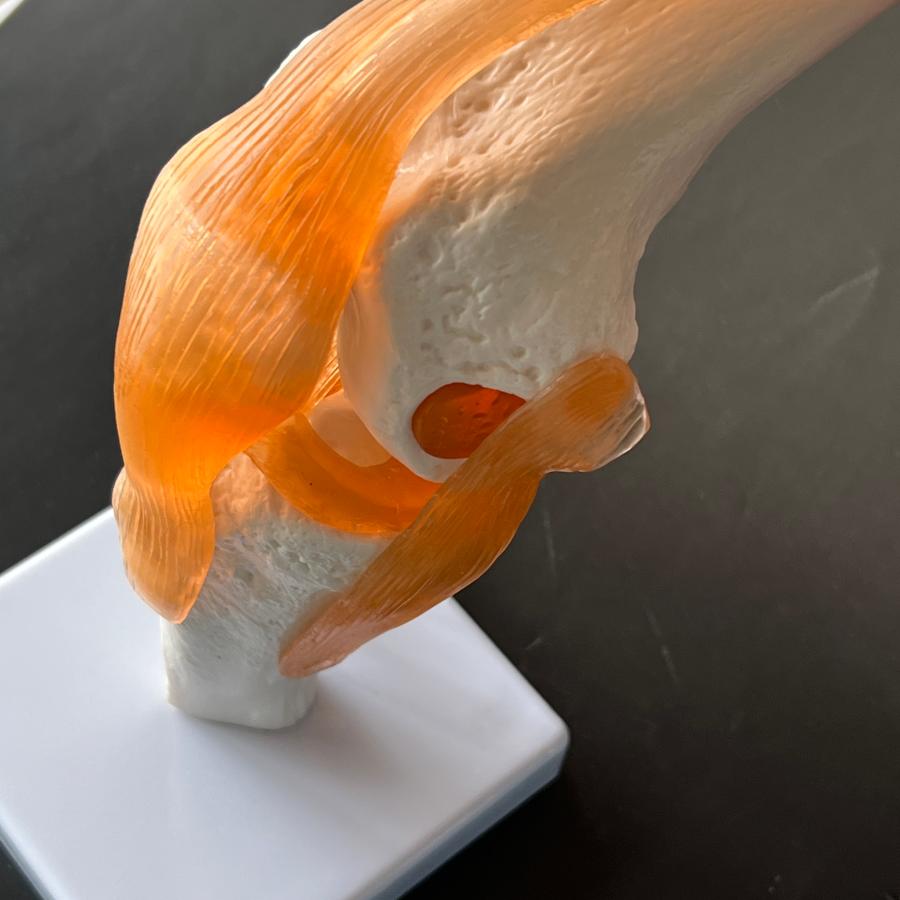 医学模型 膝関節模型 膝関節症 膝の痛み 膝関節可動解剖学模型 : 人体