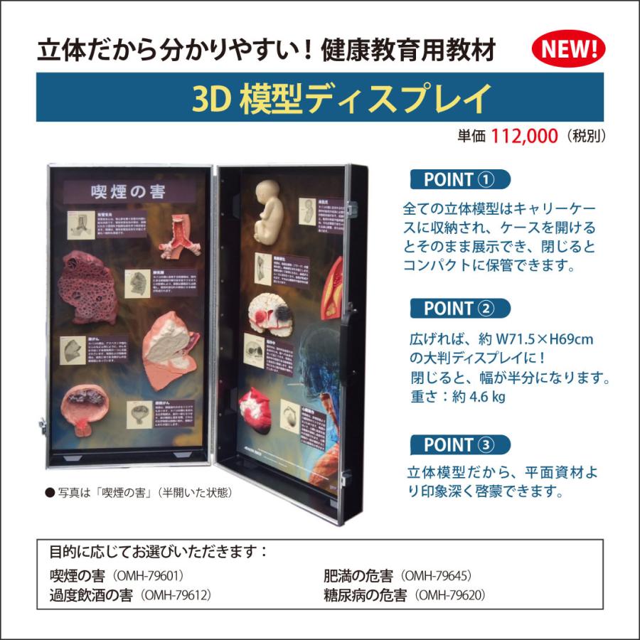 お買い得！ 「 喫煙の害」立体模型ディスプレイ 禁煙指導 タバコの危害 啓蒙教材 【TMF1938736976】(68750円)