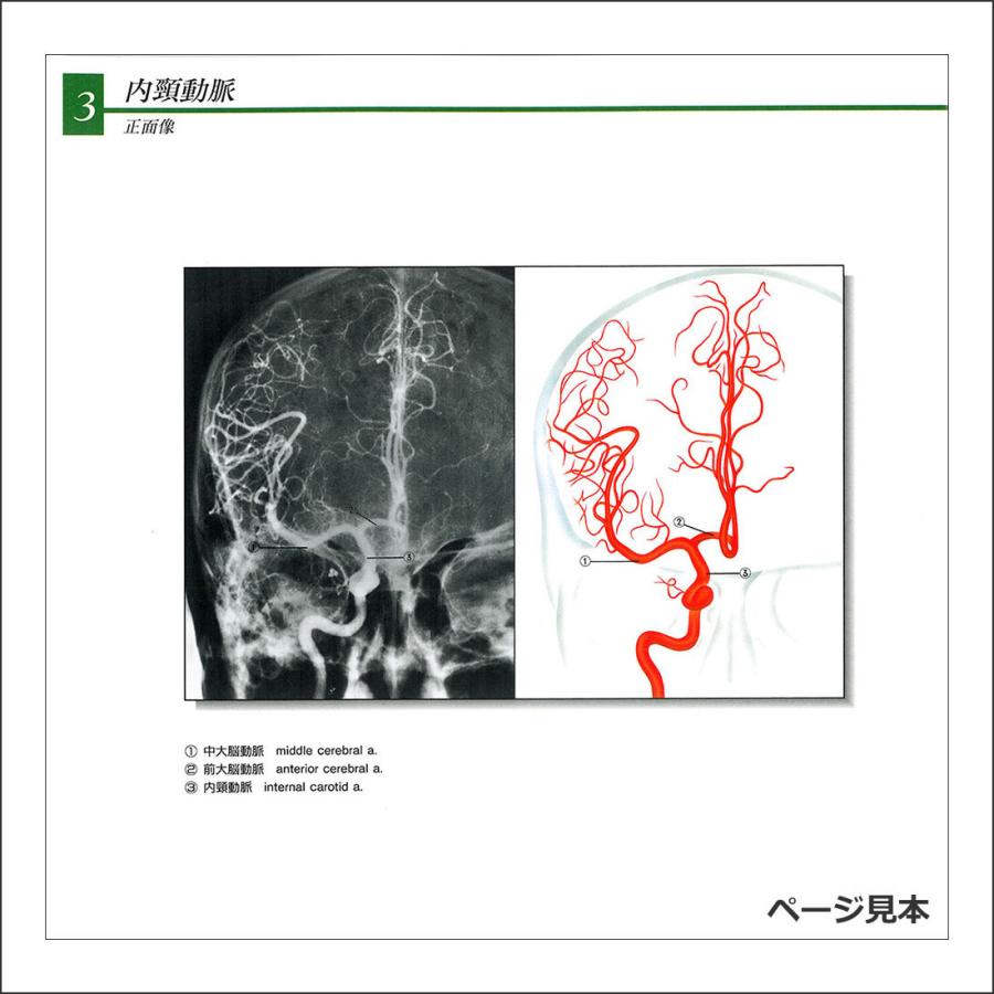 造影写真付 血管カラーアトラス」解剖学図鑑 医学書籍 : 人体