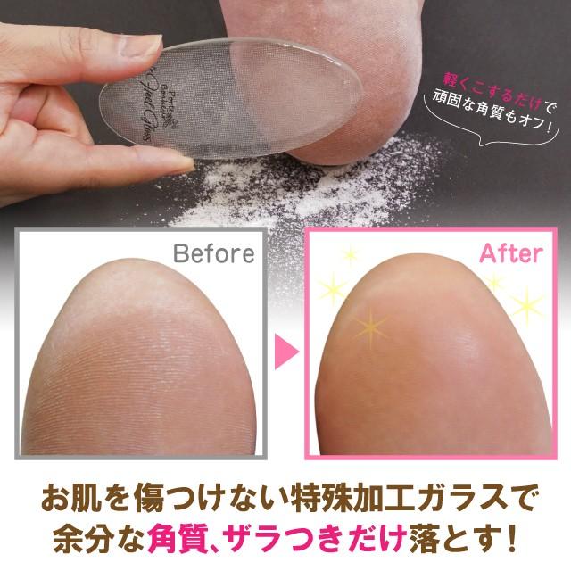 シマウマ 方程式 バンド ヒール 角質 Treemontstark Com