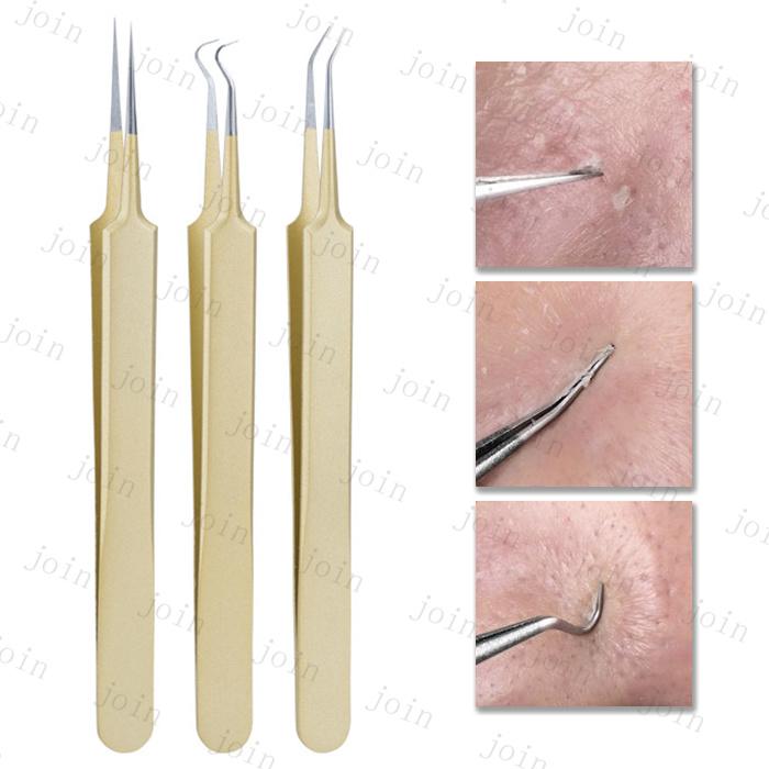 ニキビ取り 道具 日本国内当日発送 5本セット ピンセット 精密 プロ仕様 ニキビ跡 毛穴ケア 角栓 除去 コメドプッシャー ステンレス ケース付き #br130 |  | 07