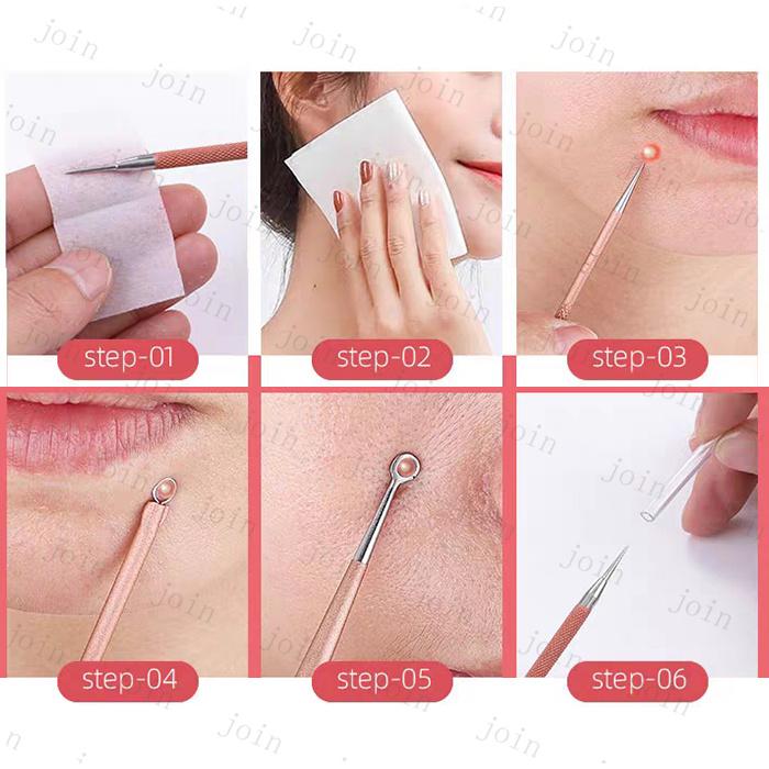 毛穴ケア専用キット (#br221) 当日発送 4本セット ニキビ取り コメド