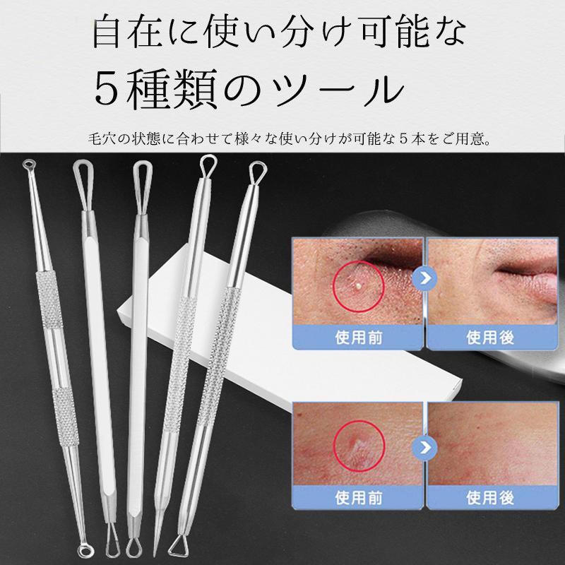 Br26 5本set ニキビ針 にきび針 黒ずみ取り ニキビ取り 毛穴ケア 専用キット ケース付き 角栓プッシャー コメドプッシャー ニキビ専用スティック Br26 ジョインショップ 通販 Yahoo ショッピング