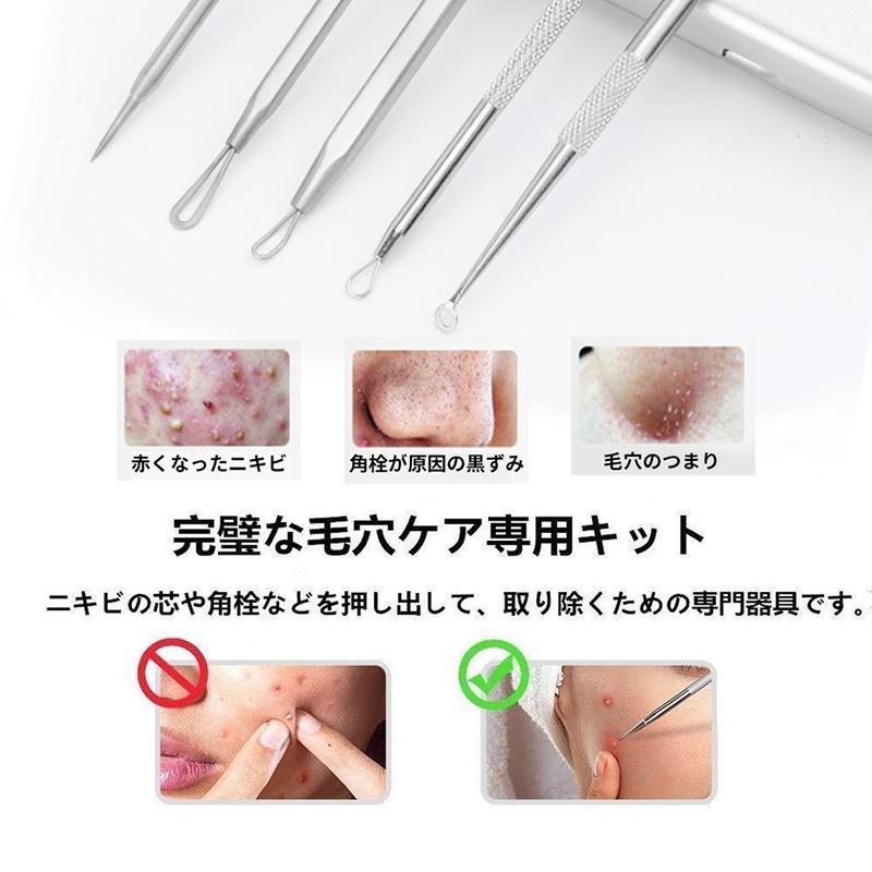 Br26 5本set ニキビ針 にきび針 黒ずみ取り ニキビ取り 毛穴ケア 専用キット ケース付き 角栓プッシャー コメドプッシャー ニキビ専用スティック Br26 ジョインショップ 通販 Yahoo ショッピング