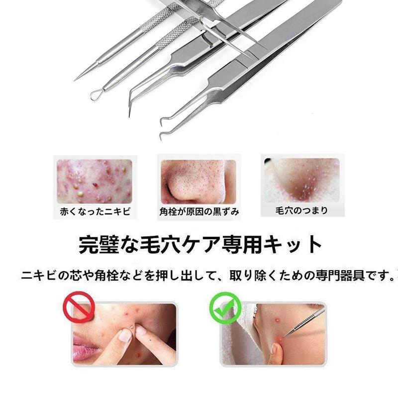 5本set毛穴ケア いちご鼻 角栓取り 角栓除去 ニキビ針 にきび針 黒ずみ取り ニキビ取り  専用キット ケース付き 角栓プッシャー #br27 |  | 07