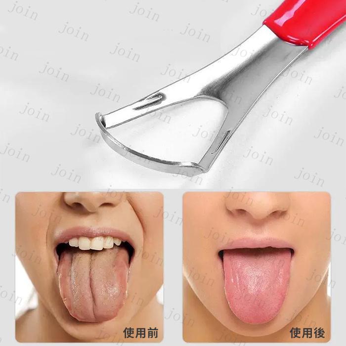 舌クリーナー (br31#) 日本国内当日発送 3本セット タングスクレーパー 舌磨き 舌ブラシ 口内ケア 舌専用 ブラシ 舌苔清掃 ステンレス 舌みがき 専用ケース付き |  | 04