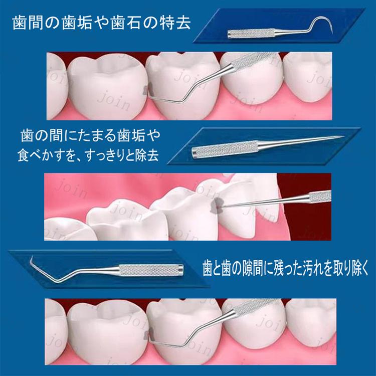 ミニ 歯石取り器具 (br45#) 日本国内当日発送 2type 歯用ツール 自宅用 3本セット ケース付き デンタルツール ステンレス製  ヤニ 歯垢取り 口臭予防 歯石取り |  | 09