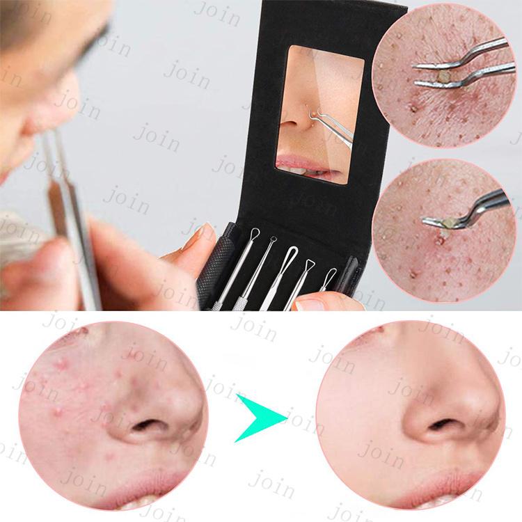 毛穴ケア 専用キット 日本国内当日発送 6本セット ニキビ取り 黒ずみ 除去 角栓取り 美容針 ツール 抗菌 角栓すっきりスティック 携帯便利 #br74 |  | 08