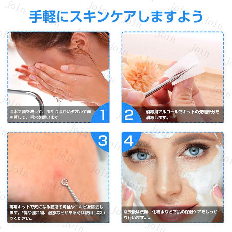 5本セット ニキビ取り 日本国内当日発送 ニキビ針 にきび針 黒ずみ取り 毛穴ケア 専用キット 角栓プッシャー 角栓 取り 圧出 除去 抗菌 #br76 |  | 11