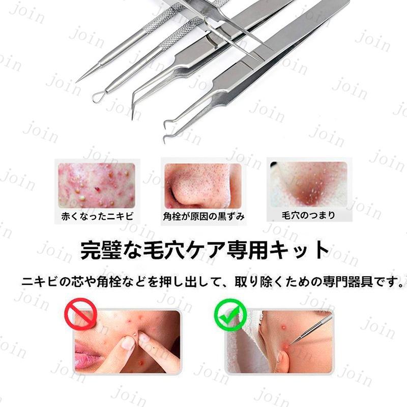 5本セット ニキビ取り 日本国内当日発送 ニキビ針 にきび針 黒ずみ取り 毛穴ケア 専用キット 角栓プッシャー 角栓 取り 圧出 除去 抗菌 #br76 |  | 08