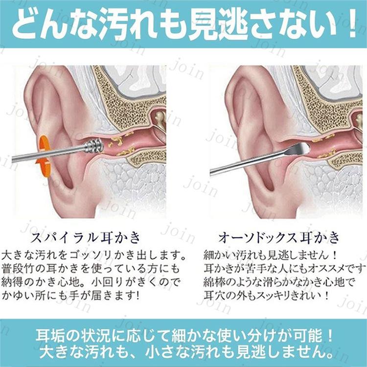Br85 耳かき 日本国内当日発送 4点セット 耳掃除 耳垢 クリーナー 耳用 大きい 小さい 手入れ 耳くそ スパイラル 耳掃除 収納ケース 携帯 持ち運び ステンレス Br85 ジョインショップ 通販 Yahoo ショッピング
