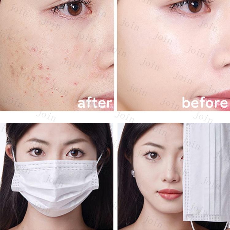 エアクッション (cs465#) 当日発送 5点セット 4リフィル ファンデーション カバー力 化粧下地 クッションファンデーション 韓国コスメ ツヤ肌 ベースメイク |  | 08