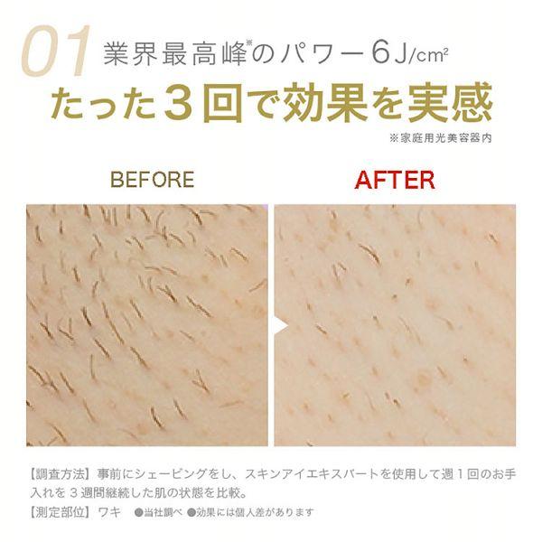 オーラルB ブラウン 脱毛器 光脱毛 BRAUN 光美容器 シルクエキスパート