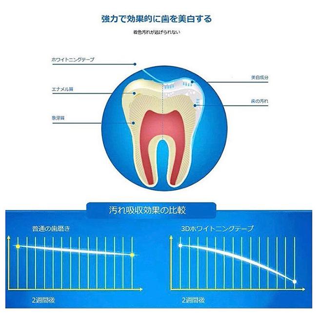ホワイトニング シート セルフ 3D 歯 ホワイト シール ハミガキ ジェル 黄ばみ ヤニ ステイン 自宅 14日間28枚入り おすすめ 市販 使い方 安い 送料無料 |  | 07