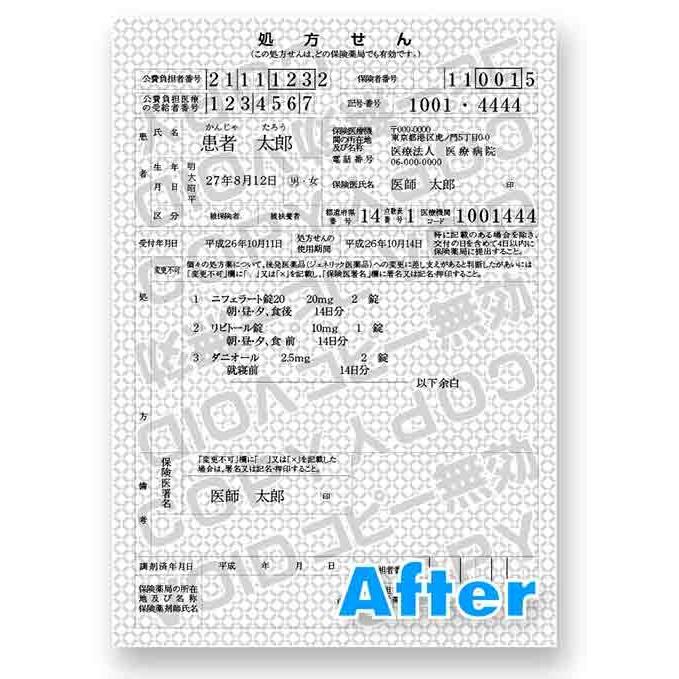 コピー防止プリンタ用紙（A5/1000枚入）】（処方せん用紙）地模様