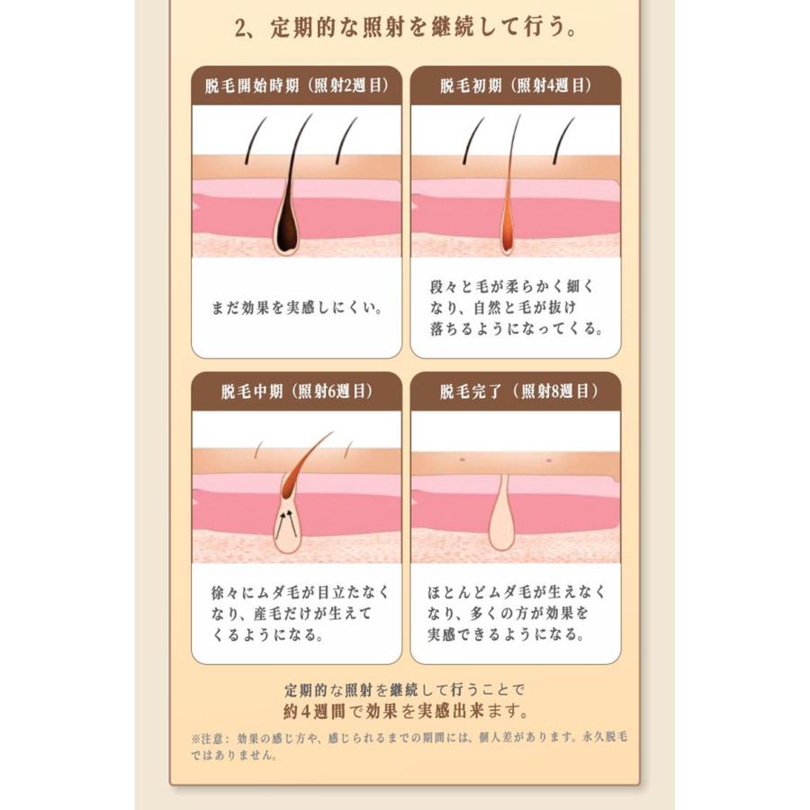 脱毛器 IPL冷感仕様脱毛 サロン級IPL脱毛 光脱毛器 ムダ毛処理 光美容