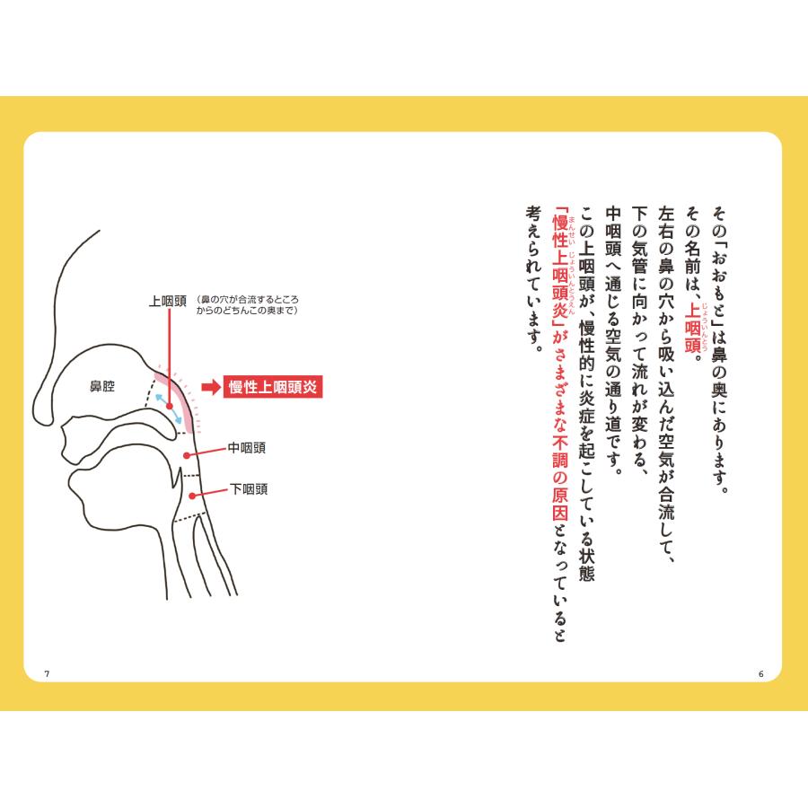 つらい不調が続いたら慢性上咽頭炎を治しなさい （単行本） |  | 05