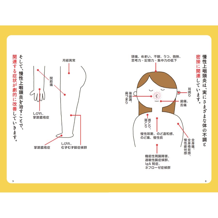 MSMプレフィア150ml「つらい不調が続いたら慢性上咽頭炎を治しなさい」セット |  | 06